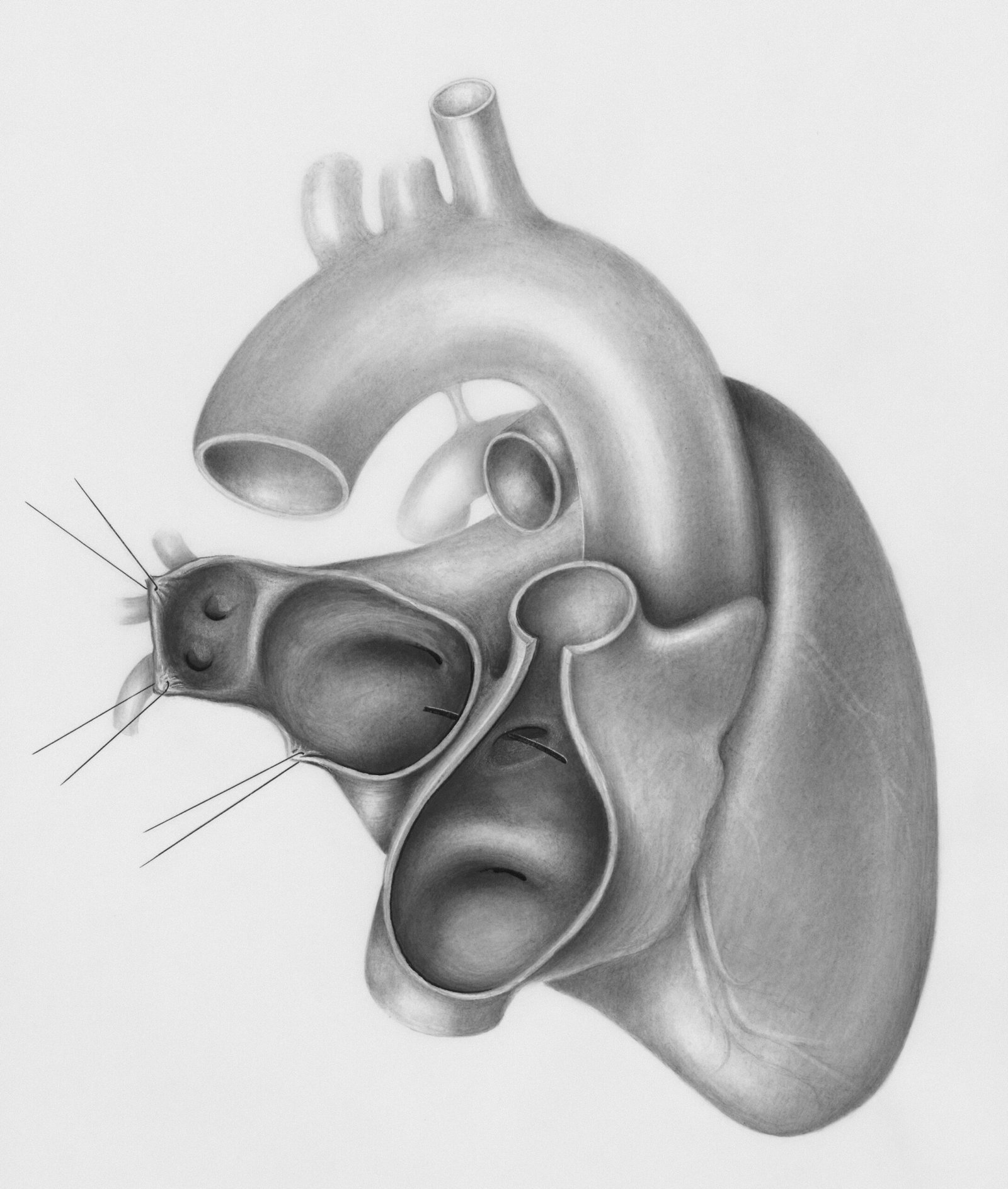 Cold-Induced Vasoconstriction: How It Works And Why It Helps