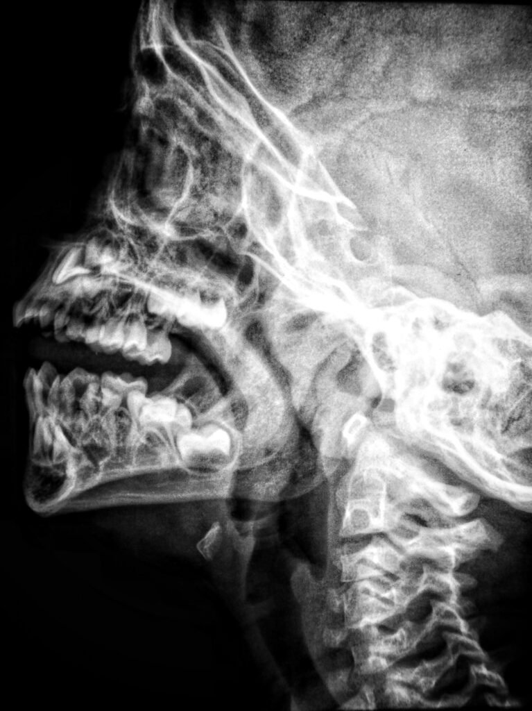 Cold Plunging And Bone Density: What Research Suggests Cold Plunging And Bone Density: What Research Suggests