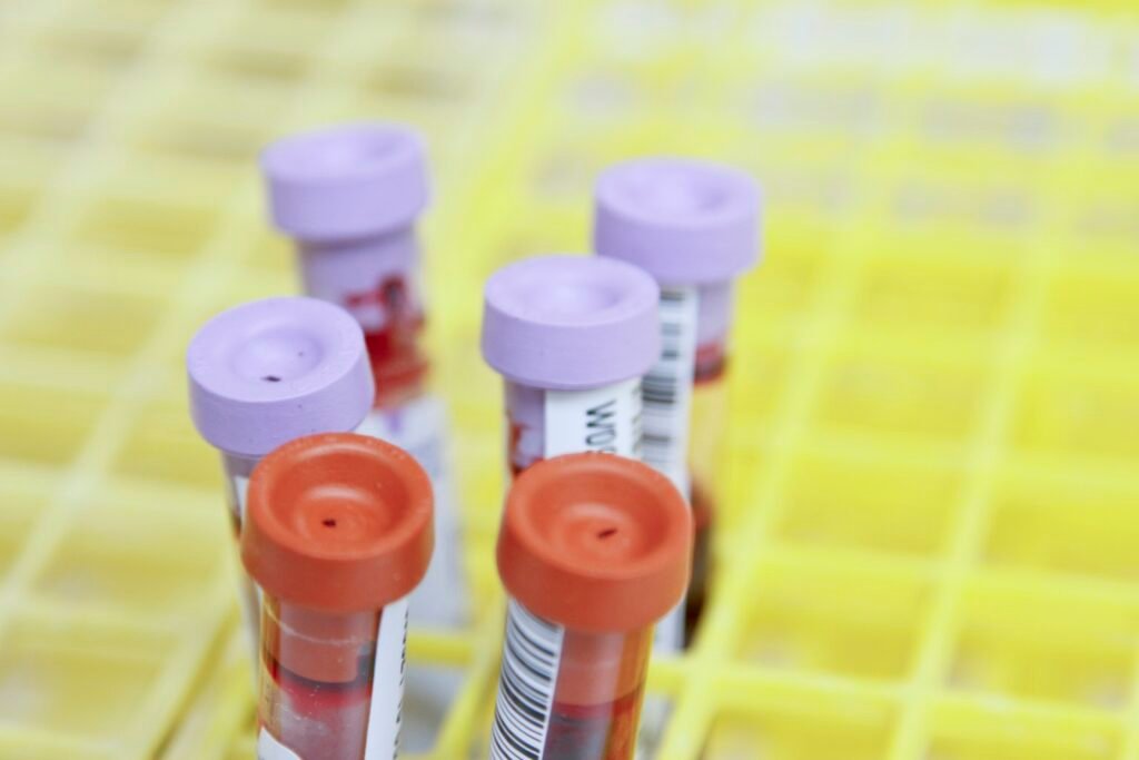 How Cold Exposure Changes Blood Chemistry How Cold Exposure Changes Blood Chemistry